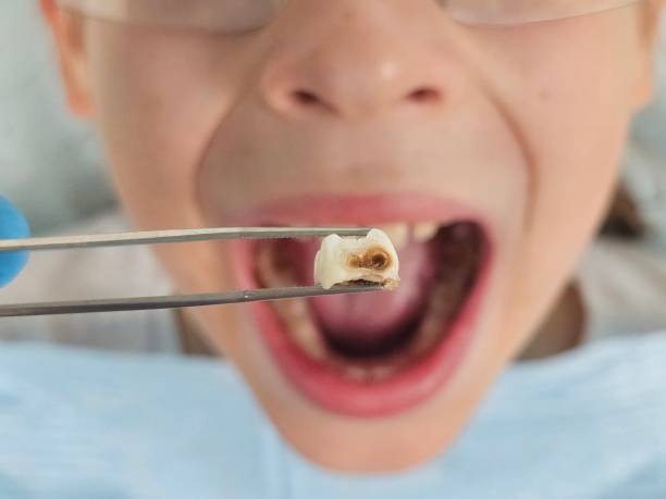 Best Pediatric Emergency Dentist in Rosemont, PA